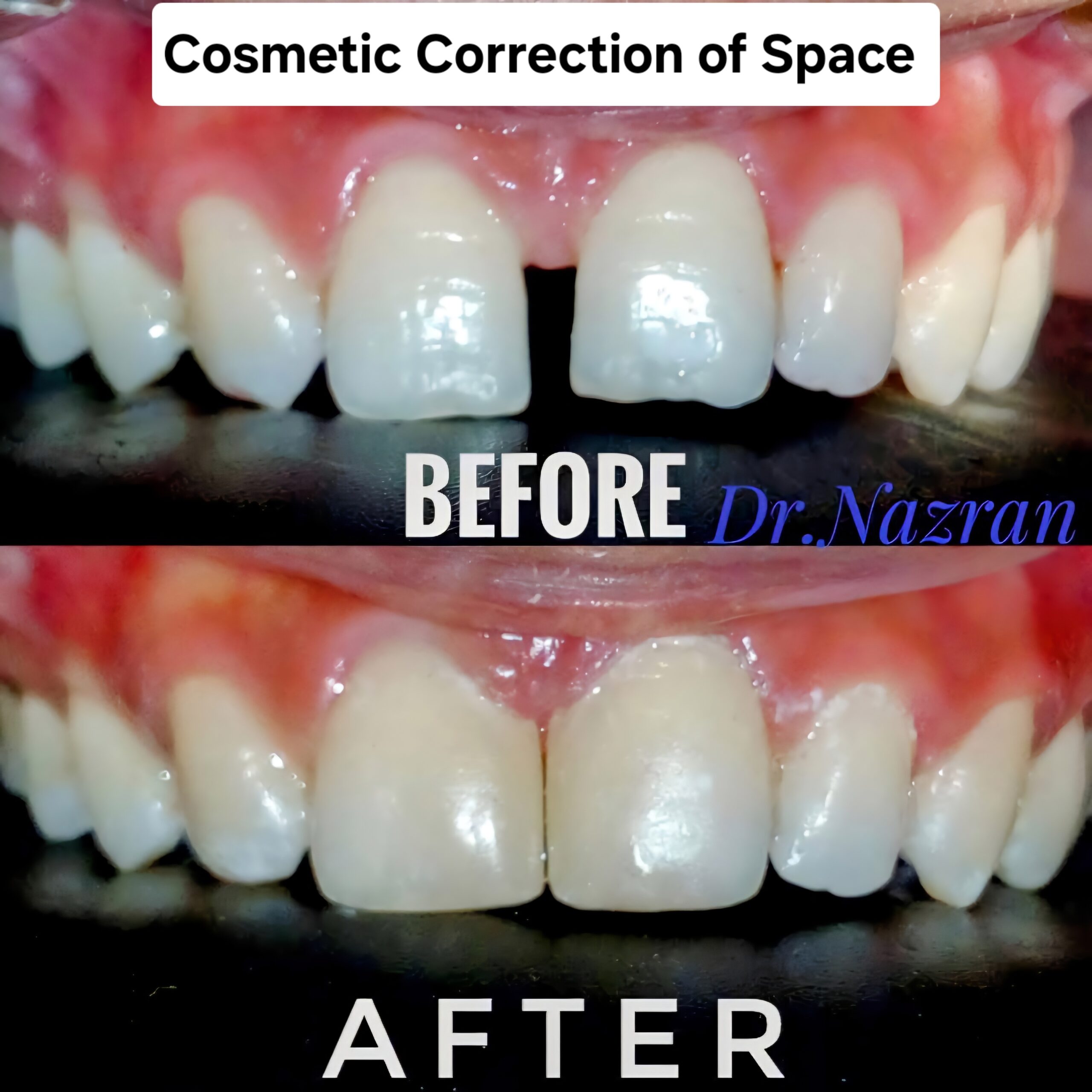 Cosmetic Correction of Space