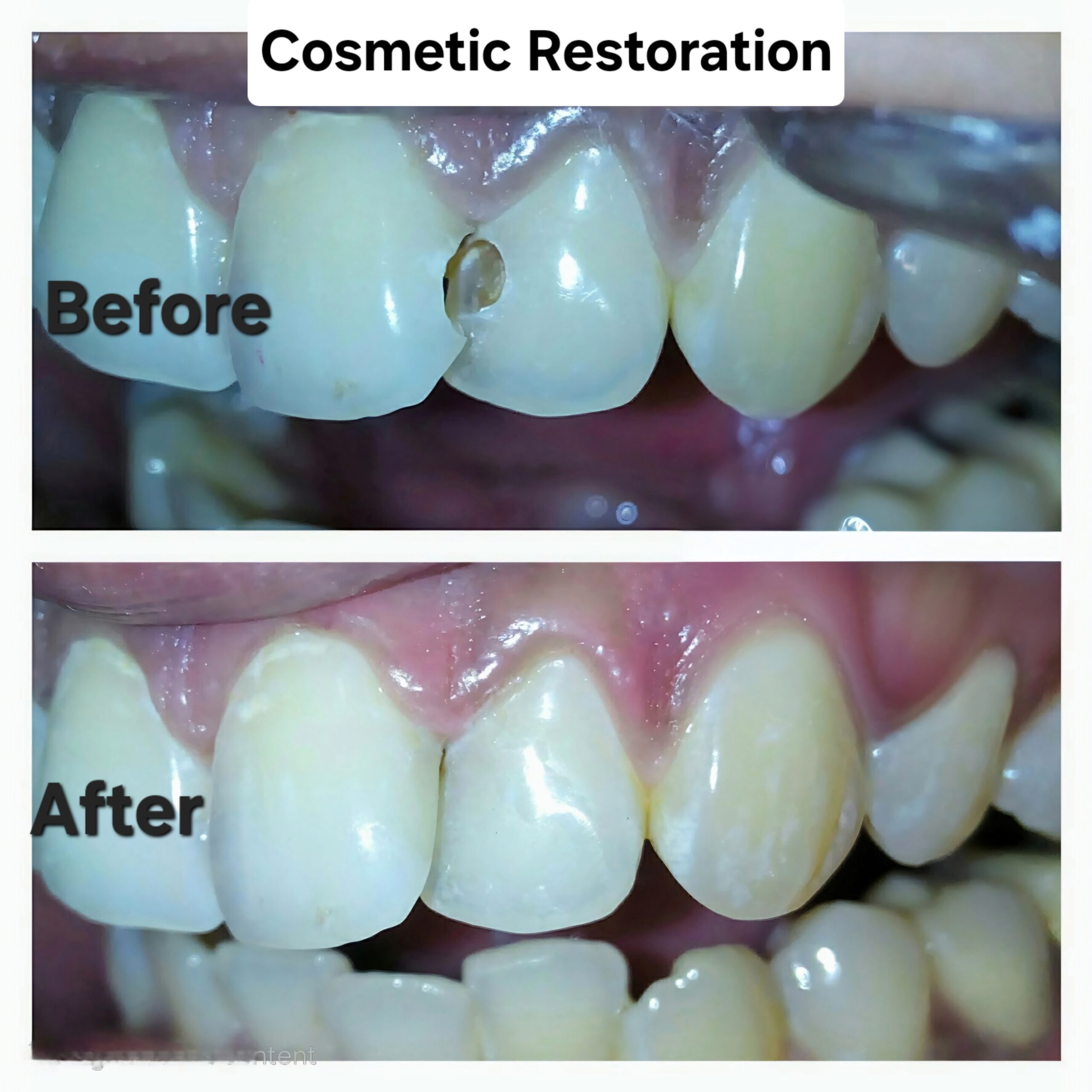 Cosmetic Restoration